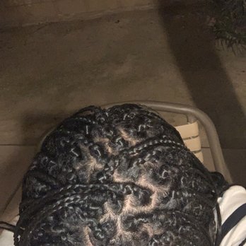 Just Gina's - Multiple patches of my real hair are showing now I have to wear hats and headbands to cover it up - Hair Salons Near Me - Palm Desert, California