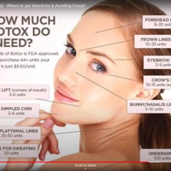 Thinking about how much Botox you might need?
