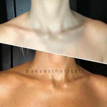 AK Aesthetics - Sunless spray tan - Skin Care Near Me AK Aesthetics - Sunless spray tan - Skin Care Near Me