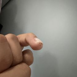 Elysian Nail Bar - They filed so much on the skin, that it was bleeding now it looks infected.