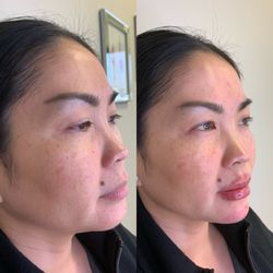 Bella Rosa Skin Rejuvenation Clinic
