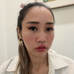 Lip filler Lip filler