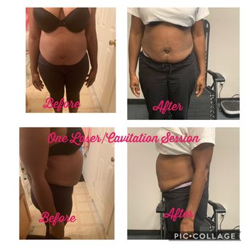 lipo c houston Lipo-C – Toronto Peptides (PC)