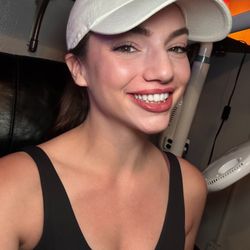 White Teeth USA - My teeth after the service!