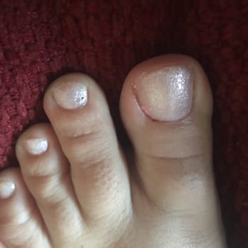 Europe Nails - The one heart that I got on my big toe as well as the toe next to it that was bumped and ruined. - Nail Salons Near Me - Bridgeville, Pennsylvania Europe Nails - The one heart that I got on my big toe as well as the toe next to it that was bumped and ruined. - Nail Salons Near Me - Bridgeville, Pennsylvania
