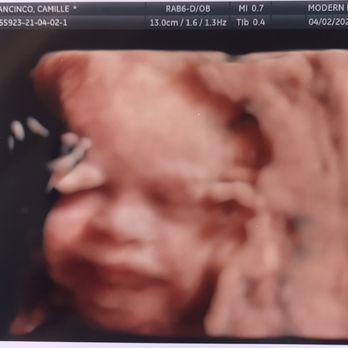 Urgent Diagnostic Imaging Center - Our Baby Nugget is smiling - Diagnostic Imaging Near Me - Glendale, California Urgent Diagnostic Imaging Center - Our Baby Nugget is smiling - Diagnostic Imaging Near Me - Glendale, California