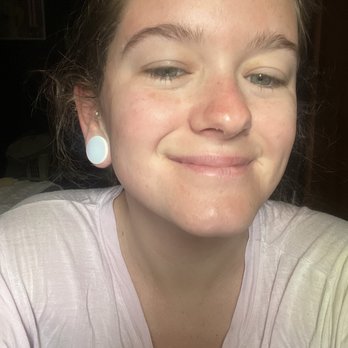 Project Gorgeous - The morning after my Triple Threat treatment! Glowing and firm. - Acupuncture Near Me - Indianapolis, Indiana