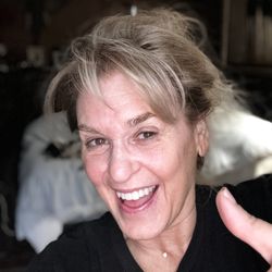 Irmo Smiles - Wearing nothing but a SMILE that I feel so proud to show the world how happy I am thx to Dr. Misti Raman. Straightened & blk gum GONE!!!