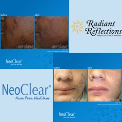 Radiant Reflections Weight Loss Clinic and MedSpa