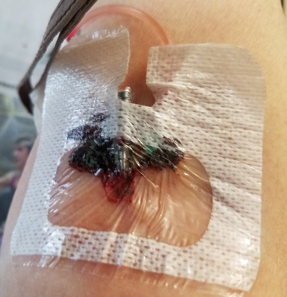 Ephrata Community Hospital - patient advocate in Ephrata, PA