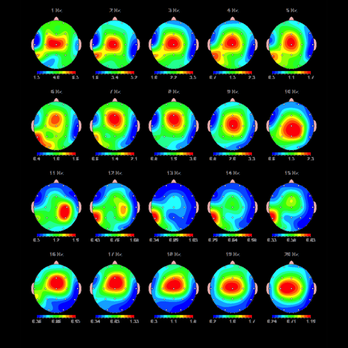 Peak Neurofitness - Brain maps help us understand how your brain is working. We use maps to develop custom training program to help your brain function better. - Counseling & Mental Health Near Me - Arlington, Virginia Peak Neurofitness - Brain maps help us understand how your brain is working. We use maps to develop custom training program to help your brain function better. - Counseling & Mental Health Near Me - Arlington, Virginia