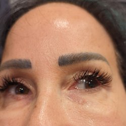 Hello Beautiful - Styes caused by injections.