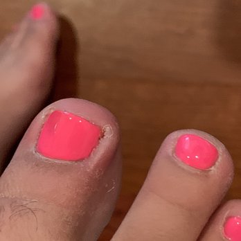 DL NAIL SPA - I got an infection and it's sooo painful. - Nail Salons Near Me - Pleasant Hill, California DL NAIL SPA - I got an infection and it's sooo painful. - Nail Salons Near Me - Pleasant Hill, California