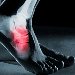 Jersey Foot & Ankle Institute