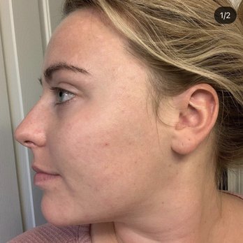 Natural Look Now - After ~6 laser treatments by Regina - Permanent Makeup Near Me - Scottsdale, Arizona Natural Look Now - After ~6 laser treatments by Regina - Permanent Makeup Near Me - Scottsdale, Arizona