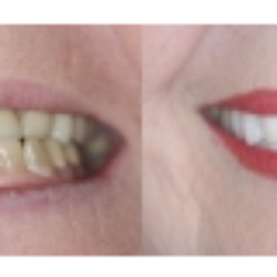 Alexander Larsen, DDS - Gentle Dental Arts