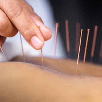 Breathing Hands Wellness and Acupuncture PLC - Acupuncture treatment - Massage Therapy Near Me Breathing Hands Wellness and Acupuncture PLC - Acupuncture treatment - Massage Therapy Near Me