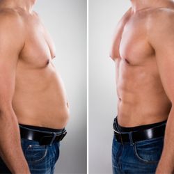 Aesthetics Body Sculpting