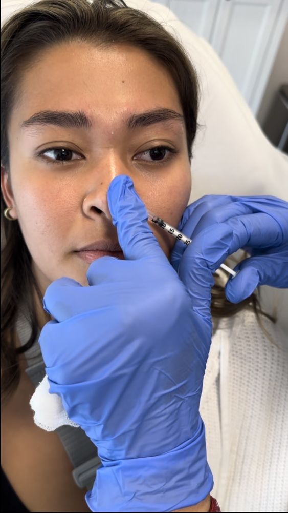 Angilee Med Spa Logo