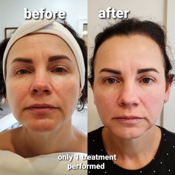 SCULPTIKO BEAUTY - 15 Photos - 7275 w 88th Ave, Westminster, CO - Yelp