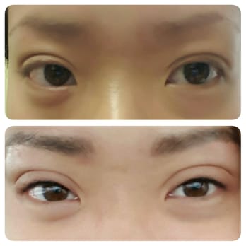Tiffany Hur Makeup Artist - Before & right after eyebrow + eyeliner tattoos (thickness/darkness will reduce by about 1/3) - Massage Near Me - Glenview, Illinois