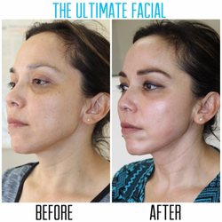 The Ultimate Facial