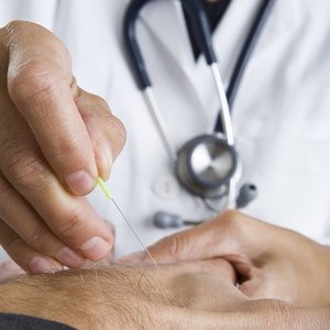 R.A. Acupuncture on Yelp