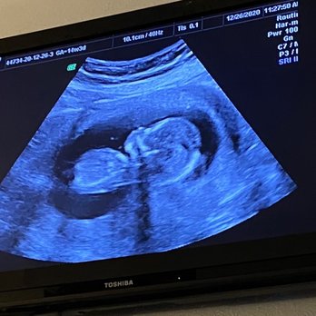 First Look Ultrasound - First picture of many more - Diagnostic Imaging Near Me - Kaneohe, Hawaii