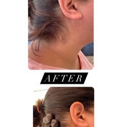 ME Aesthetics - Hairline wax