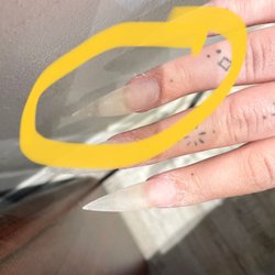 Sunshine Nails - This is how my nail was after going to sunshine nails. Crooked and not pointing in the same direction as the others