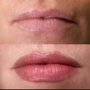 Photo of Cosmetic Candi