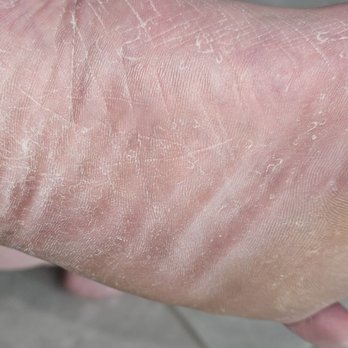 The Polished Nails & Day Spa - Bottom doest look any better at all Dry & calluses - Day Spas Near Me - Estero, Florida The Polished Nails & Day Spa - Bottom doest look any better at all Dry & calluses - Day Spas Near Me - Estero, Florida