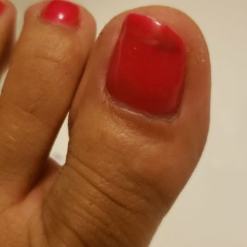Mega Nails - Healing fungus from a toenail i thought I was going to loose - Nail Technicians Near Me - San Jose, California