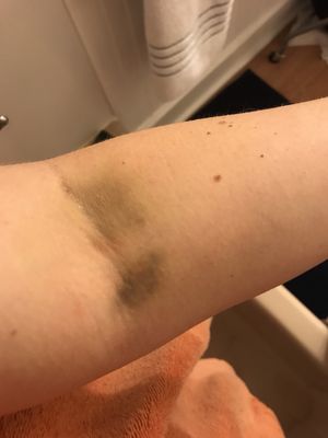 Hackensack Meridian Mountainside Medical Center by null