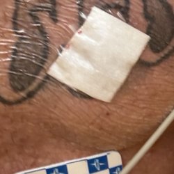 Eisenhower Desert Cardiology Center - Heart surgery device implant