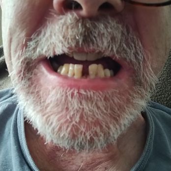 Leckowicz Walter Jr PC - when insurance would pay... then he took the one on either sidemaking me ineligible for my insurance paying... - General Dentistry Near Me - Newington, Connecticut Leckowicz Walter Jr PC - when insurance would pay... then he took the one on either sidemaking me ineligible for my insurance paying... - General Dentistry Near Me - Newington, Connecticut