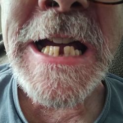 Leckowicz Walter Jr PC - When insurance would pay... then he took the one on either sidemaking me ineligible for my insurance paying...