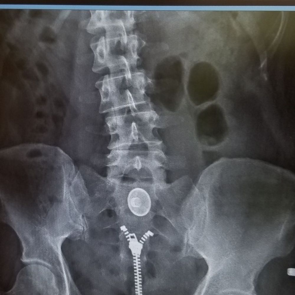 Euclid Chiropractic - Chiropractors Near Me - Upland, California