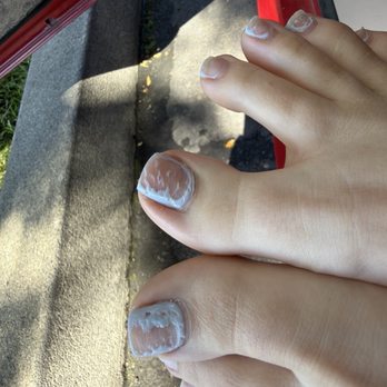 Superior Nail - Pedicure removal fail - Nail Salons Near Me - Sacramento, California Superior Nail - Pedicure removal fail - Nail Salons Near Me - Sacramento, California
