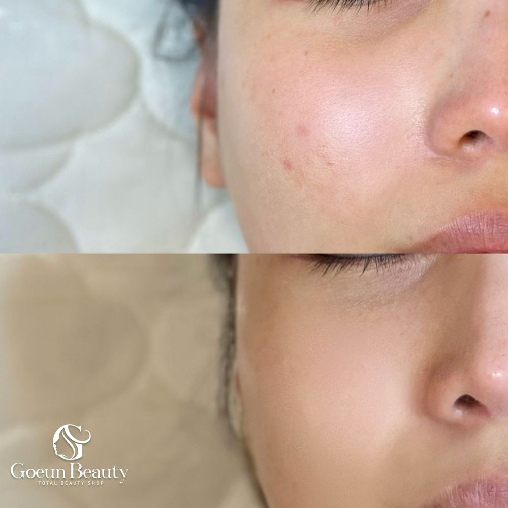 GOEUN BEAUTY Updated July 2024 63 Photos & 34 Reviews 1812