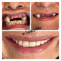 OC Splendid Smiles - Smile makeover! 949-855-3368 ocsplendidsmiles.com