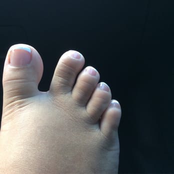 Bella Nails & Spa - Excuse the swollen feet but Lisa did a wonderful job on my French tip pedicure - Skin Care Near Me - Riverside, California Bella Nails & Spa - Excuse the swollen feet but Lisa did a wonderful job on my French tip pedicure - Skin Care Near Me - Riverside, California