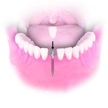 Robert S Murav, DDS - Oral Surgeons Near Me - Decatur, Michigan Robert S Murav, DDS - Oral Surgeons Near Me - Decatur, Michigan