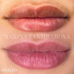 Marina Zakhrabova - Before and HEALED LIP BLUSH one session