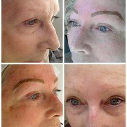 Beautiful before and afters!