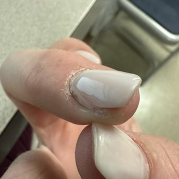 Shellac Nails & Spa - Nails at 5 days after my cuts kind of healed. My skin was so raw after this. - Nail Salons Near Me - Sacramento, California Shellac Nails & Spa - Nails at 5 days after my cuts kind of healed. My skin was so raw after this. - Nail Salons Near Me - Sacramento, California