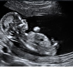 Womb in Bloom