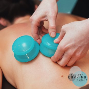 Boulder Cupping Therapy - Massage Therapy Near Me - Boulder, Colorado Boulder Cupping Therapy - Massage Therapy Near Me - Boulder, Colorado