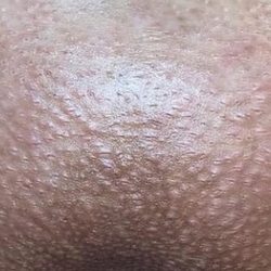 Beauty is Skin Deep by Antee - Brazilian wax