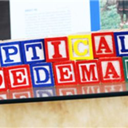Hoedeman Optical - Photo
